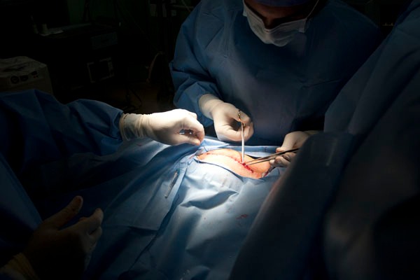 Heart Surgery in Iraq